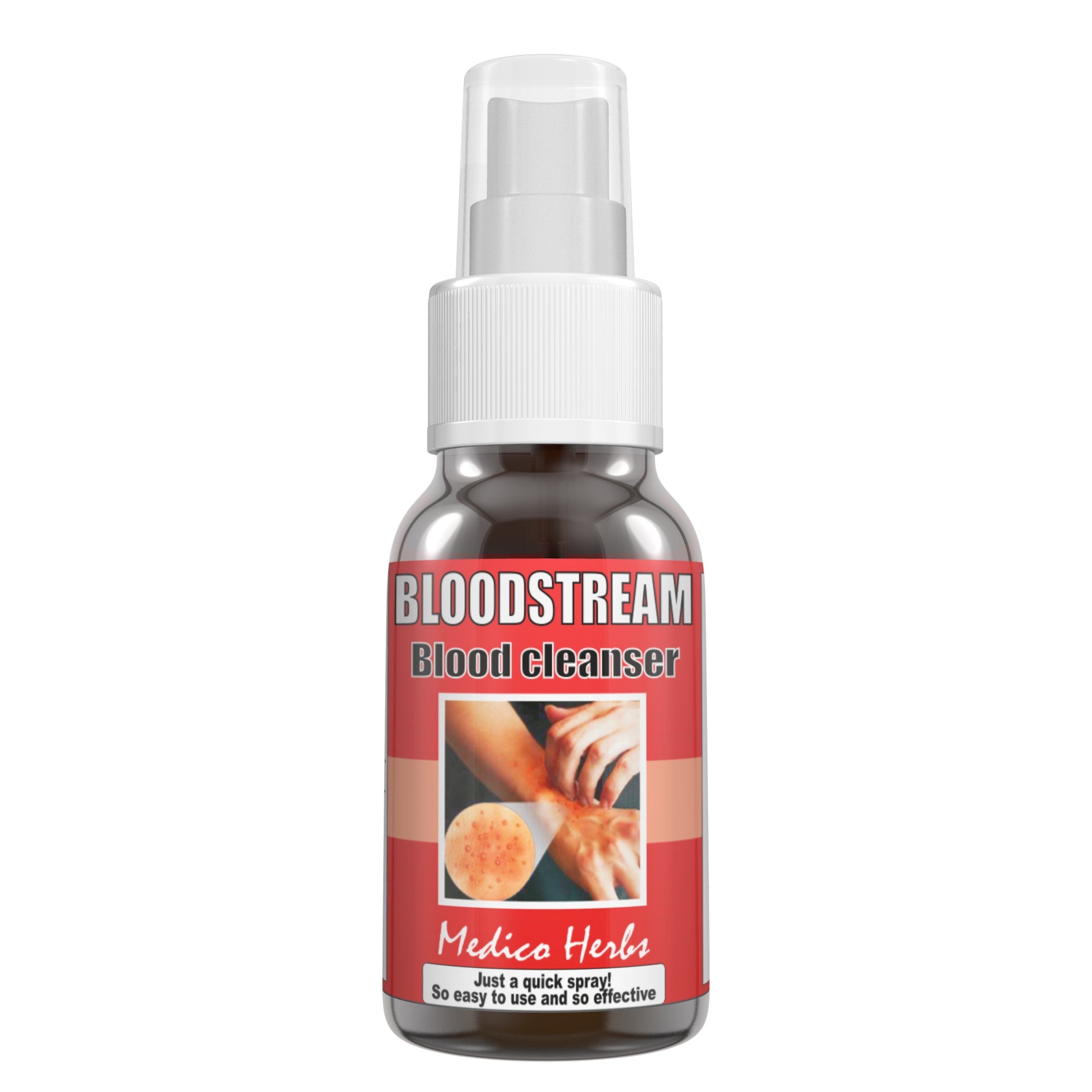 Bloodstream Spray & Kigelia Cream for Eczema, Psoriasis, Acne 100% Natural